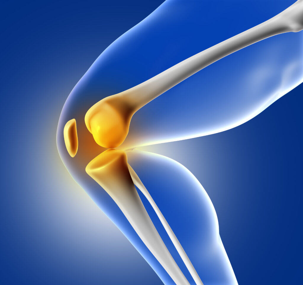 top-5-mistakes-after-knee-replacement-avoid-these-for-a-smooth