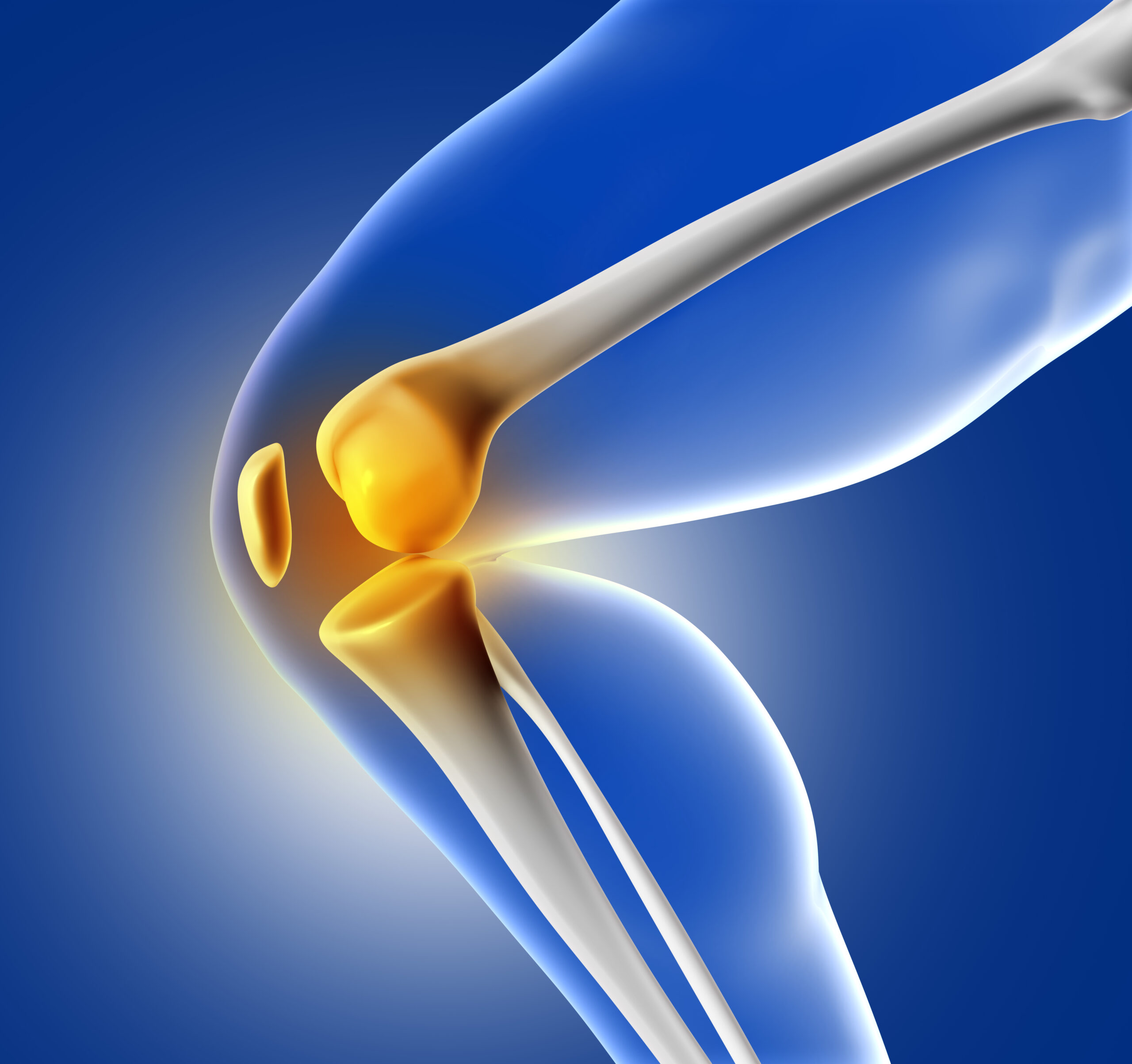 Top 5 Mistakes After Knee Replacement Avoid These For A Smooth 